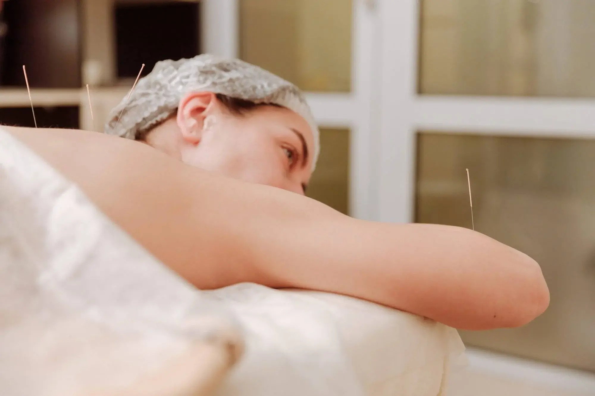 Acupunctura pentru toti